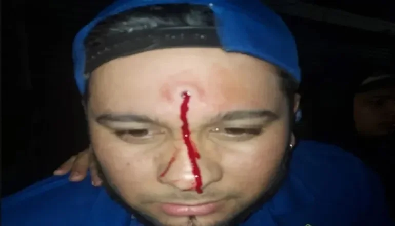 Impacto. Esteban de Jesús Vallejos mostró la herida que le dejó el proyectil.